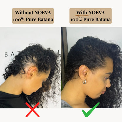 NOEVA - 100% Pure Batana