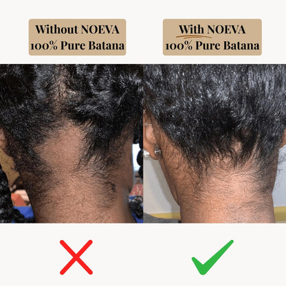 NOEVA - 100% Pure Batana