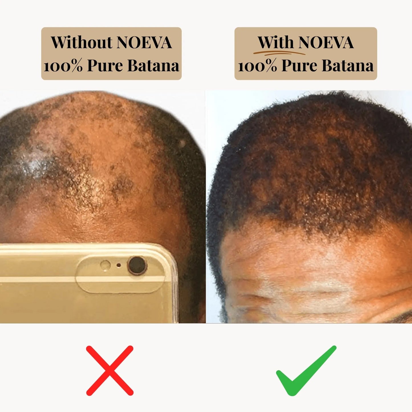 NOEVA - 100% Pure Batana